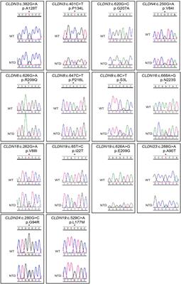 Functional Validation of CLDN Variants Identified in a Neural Tube Defect Cohort Demonstrates Their Contribution to Neural Tube Defects